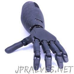 Prosthesis