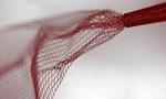 Implantable brain electronics is here