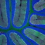 Delivering Genes Across the Blood-Brain Barrier