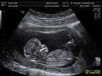 Restoring fertility with 3D printers