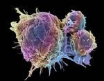 Microsoft Develops AI to Help Cancer Doctors Find the Right Treatments