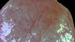 Stanford scientists create three-dimensional bladder reconstruction