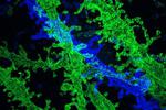High-resolution imaging with conventional microscopes