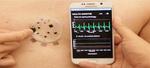 ‘Electronic skin’ takes wearable health monitors to the next level