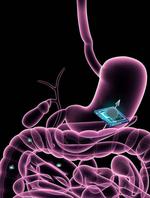 Medicine of the Future: New Microchip Technology Could Be Used to Track Smart Pills
