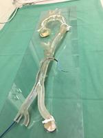 German University Hospital Mainz Pioneers Surgical Planning for Life-Saving Vascular Surgeries With 3D Printing