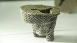 World-first: 3D printed tantalum knee joint implanted in a Chinese patient
