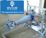 Tele Operated Bionic Arm