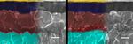 Perovskite solar cells: mesoporous interface mitigates the impact of defects