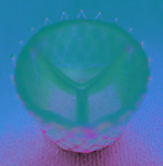Computer-Designed Customized Regenerative Heart Valves