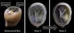 New 3D printing technique enables faster, better, and cheaper models of patient-specific medical data for research and diagnosis