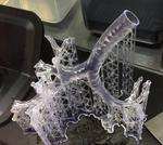 Please Touch: 3D Printed Anatomy Can Make Surgery A Hands-On Experience For Everyone