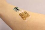 Smart bandages designed to monitor and tailor treatment for chronic wounds