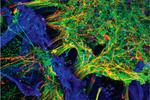 Tufts scientists grow functioning human neural networks in 3D from stem cells