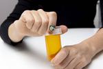 Fingernail Sensors and AI Can Help Clinicians to Monitor Health and Disease Progression
