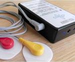 ECG Logger - a Wearable Cardiac Monitor for Long-Term Data Acquisition and Analysis