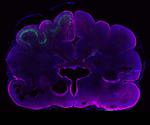 Building a bigger brain