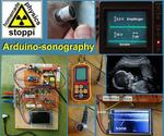 Body-ultrasound Sonography With Arduino