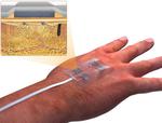 UConn Biomedical Engineer Creates “Smart” Bandages to Heal Chronic Wounds