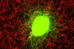A 3d-printed Brain Could Make It Easier To Find Cancer Treatments