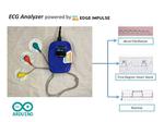 ECG Analyzer Powered by Edge Impulse