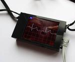 ECG Display With Arduino