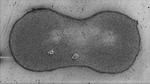 Stabiliser residue in inks inhibits conductivity in 3D printed electronics