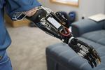 First-Hand Experience: Deep Learning Lets Amputee Control Prosthetic Hand, Video Games