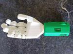 Myoelectric sensor-controlled hand prosthesis