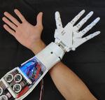 3D Printed EMG Prosthetic Hand
