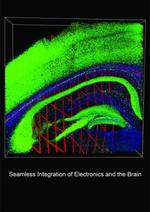 For the first time, it’s possible to record long-term electrical activity in a single brain cell