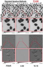 Physics informed self-supervised learning framework could make computational imaging faster